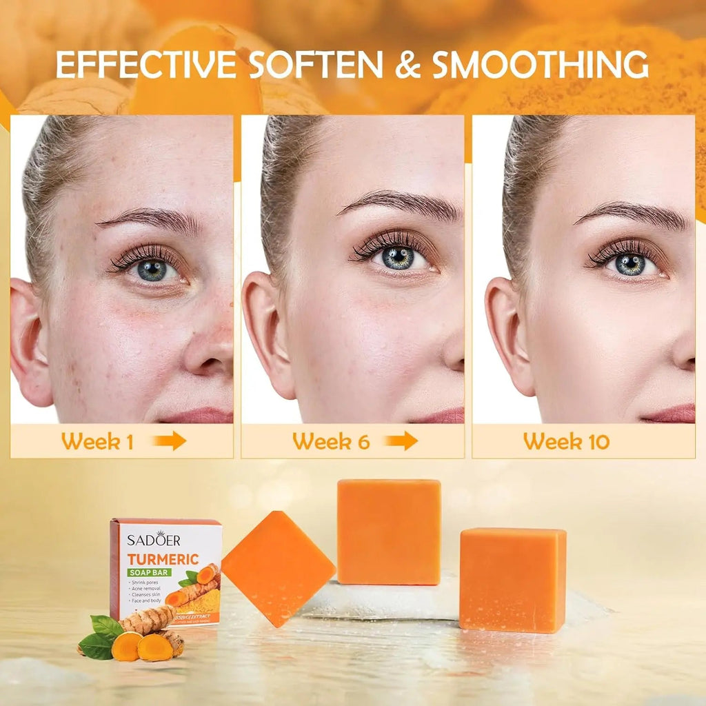 Turmeric Soap Turmeric Acne Dark Spots Smooth Skin, Handmade Soap Bar Pure Soap Bar For Face & Body, Skincare Face Care, Moisturizing, Blackhead Corrector Remover, Moisturizing Erase Fine Lines(1 PCS)